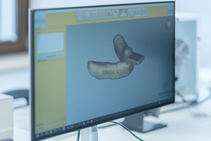 Kunststoffprodukte per 3D-Druck